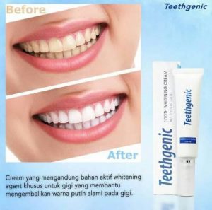 Erto’s Teethgenic Tooth Whitening Cream liputantimes.com.jpeg