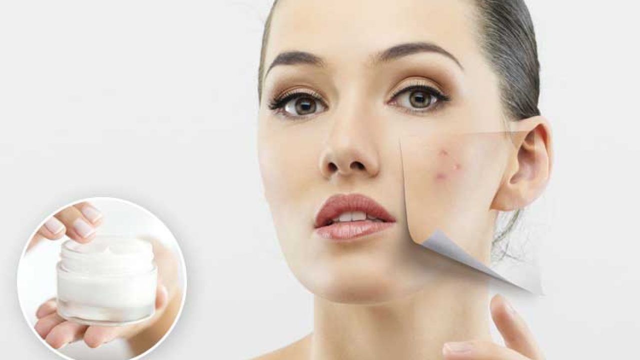 Krim Penghilang Bekas Jerawat Terbaik liputantimes.com