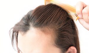 shampoo untuk rambut rontok terbaik