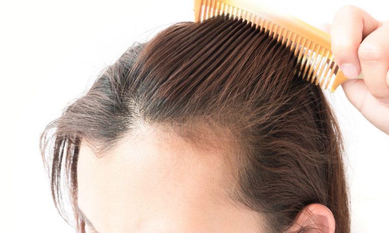 shampoo untuk rambut rontok terbaik
